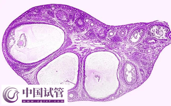河南省人民医院做试管婴要准备什么(图3) 河南省人民医院做试管婴要准备什么(图3)
