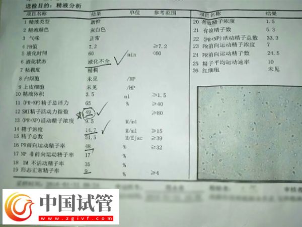 河南省人民医院做试管婴要准备什么(图2) 河南省人民医院做试管婴要准备什么(图2)