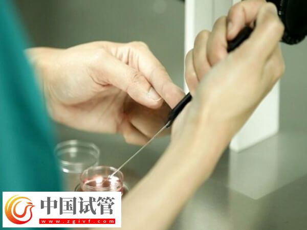 试管移植成功的经验有哪些(图1) 试管移植成功的经验有哪些(图1)