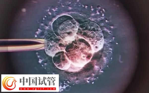 移植一个冻胚8c2成功率高不高(图1) 移植一个冻胚8c2成功率高不高(图1)