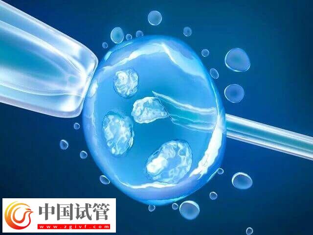 试管卵泡16mm取了能不能配成(图1) 试管卵泡16mm取了能不能配成(图1)