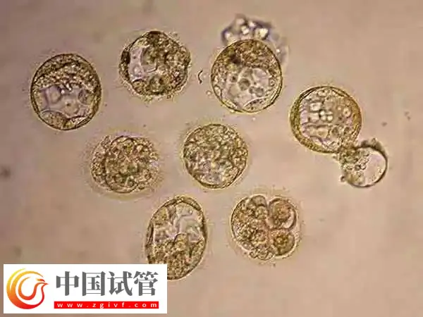 胚胎培养需要多长时间(图1) 胚胎培养需要多长时间(图1)