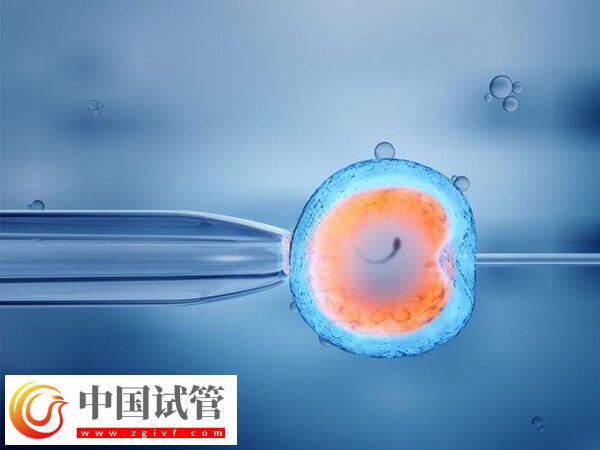 50岁试管婴儿的条件有哪些(图1) 50岁试管婴儿的条件有哪些(图1)