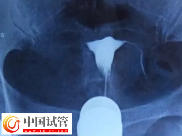 北京试管婴儿要什么证件(图2) 北京试管婴儿要什么证件(图2)