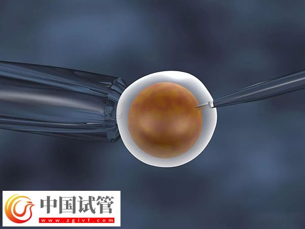 2025在西班牙做试管婴儿需要什么条件(图3) 在西班牙做试管婴儿需要什么条件(图3)