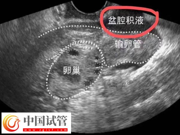 2025在西班牙做试管婴儿需要什么条件(图4) 在西班牙做试管婴儿需要什么条件(图4)