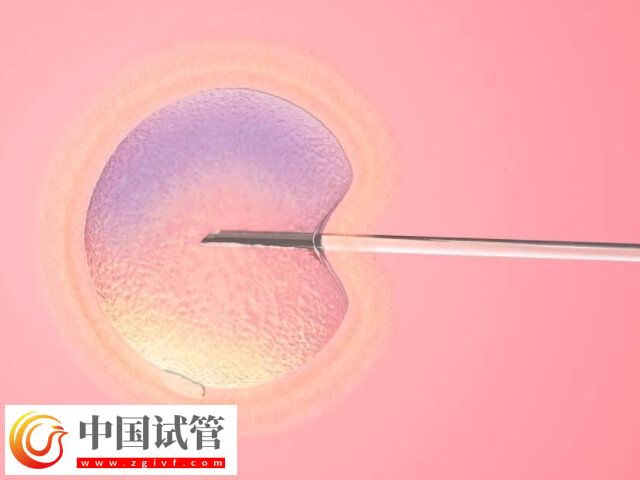 为什么子宫大不能移植胚胎(图1) 为什么子宫大不能移植胚胎(图1)