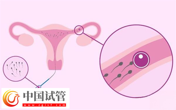在武汉协和医院申请供精能做几次(图3) 在武汉协和医院申请供精能做几次(图3)