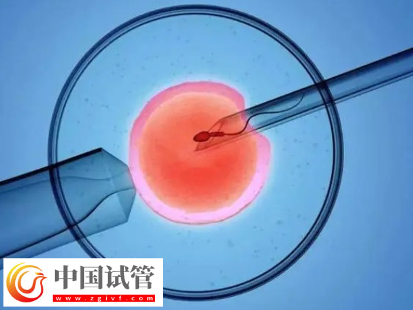 高龄试管有什么风险(图2) 高龄试管有什么风险(图2)
