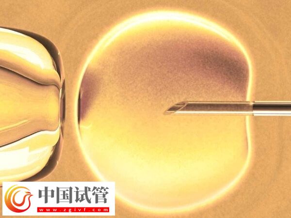 卵泡期长方案适合哪些人(图1) 卵泡期长方案适合哪些人(图1)