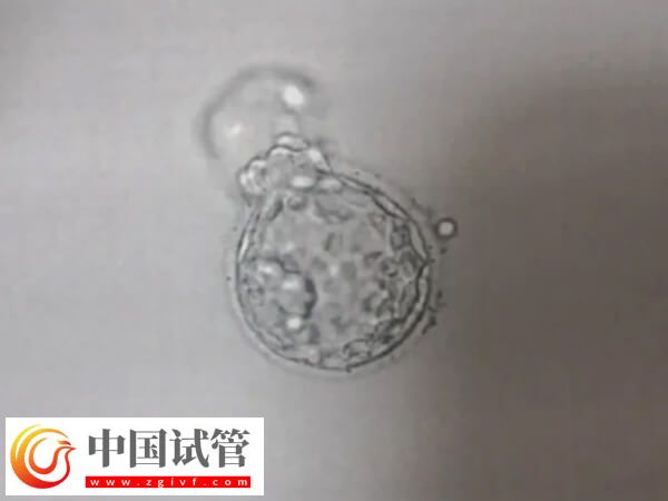 鲜胚成功率为什么低(图2) 鲜胚成功率为什么低(图2)