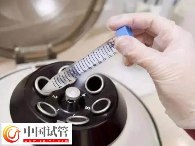 试管睾丸穿刺取精要穿刺几次(图2) 试管睾丸穿刺取精要穿刺几次(图2)