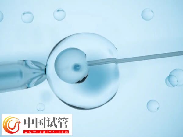 试管睾丸穿刺取精要穿刺几次(图1) 试管睾丸穿刺取精要穿刺几次(图1)