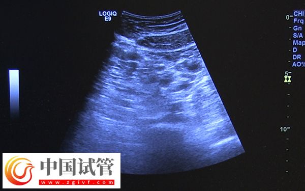 咸宁市中心医院监测卵泡多少钱(图1) 咸宁市中心医院监测卵泡多少钱(图1)