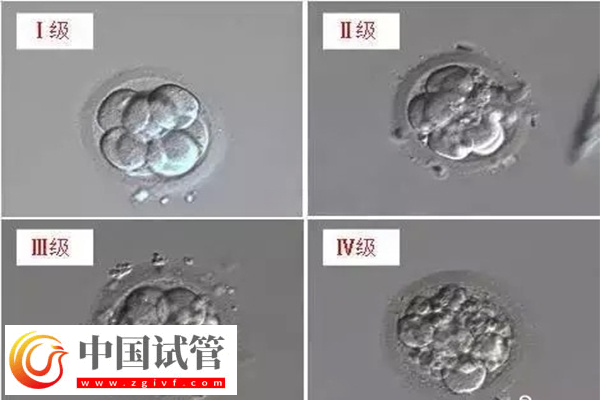 4个胚胎做试管够不够(图1) 4个胚胎做试管够不够(图1)