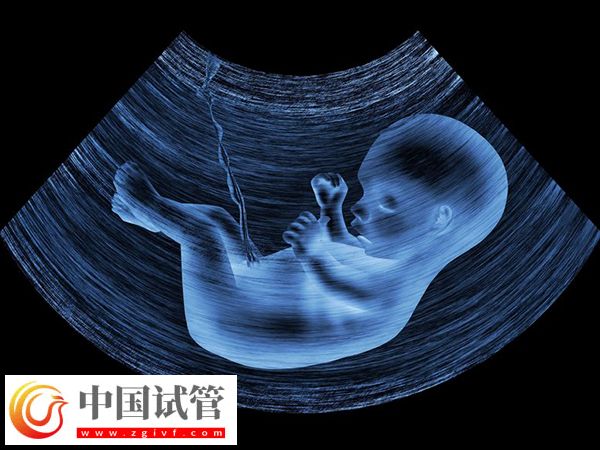 实施试管怀孕4个月稳不稳定(图3) 实施试管怀孕4个月稳不稳定(图3)
