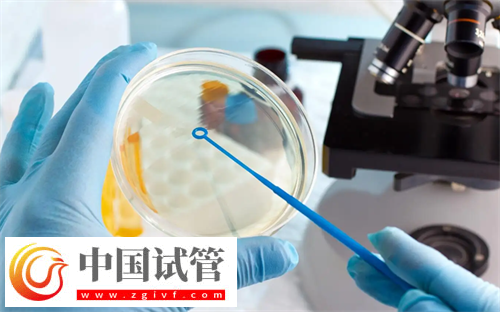 多囊患者试管选择什么方案好?(图1) 多囊患者试管选择什么方案好?(图1)