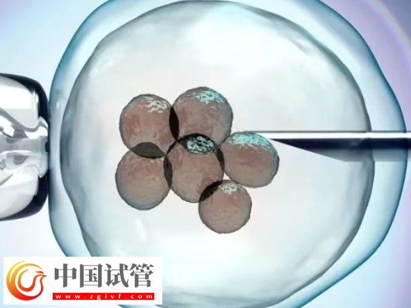 湘雅和武汉试管哪家好(图1) 湘雅和武汉试管哪家好(图1)