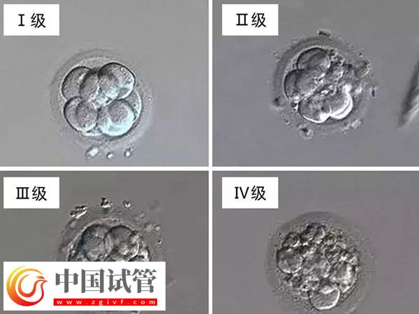 南昌妇幼做试管医生排名(图2) 南昌妇幼做试管医生排名(图2)