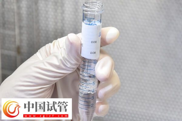 高龄试管婴儿容不容易畸形(图1) 高龄试管婴儿容不容易畸形(图1)
