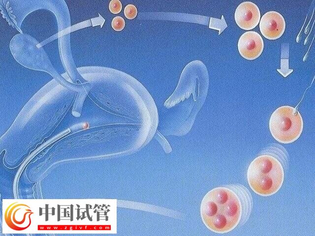 试管婴儿不适用于哪些人(图1) 试管婴儿不适用于哪些人(图1)