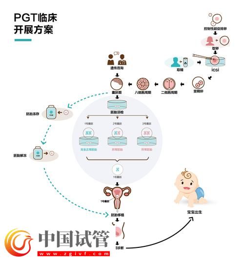 试管婴儿从取卵到胚胎移植的完整流程(图1) 试管婴儿从取卵到胚胎移植的完整流程(图1)
