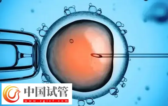 深圳生殖中心最好的医院:深圳市人民医院排在榜首(图3) 深圳生殖中心最好的医院:深圳市人民医院排在榜首(图3)