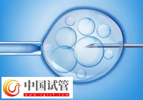 济南2025试管助孕代/怀产子机构名单,附流程与费用介绍(图1) 济南2025试管助孕代/怀产子机构名单,附流程与费用介绍(图1)