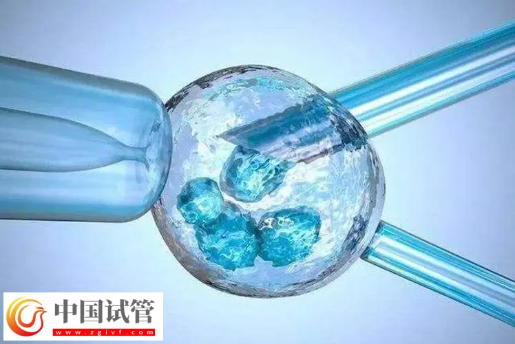 北京试管助孕大概要多少钱?这是2024最新收费标准(图3) 北京试管助孕大概要多少钱?这是新收费标准(图3)