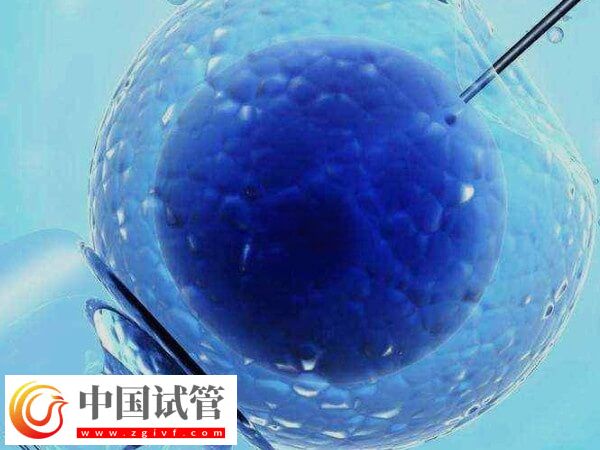 试管婴儿治疗期间可不可以同房(图1) 试管婴儿治疗期间可不可以同房(图1)