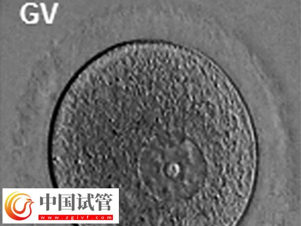 女性FSH高怎样才能降下来(图2) 女性FSH高怎样才能降下来(图2)
