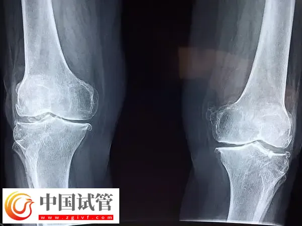 女性FSH高怎样才能降下来(图3) 女性FSH高怎样才能降下来(图3)