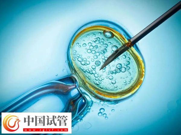 女性fsh高做试管能采用哪些方案(图1) 女性fsh高做试管能采用哪些方案(图1)