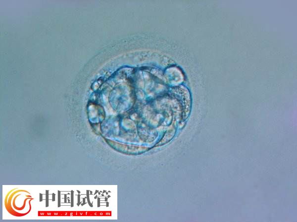 胚胎移植后哪些反应是着床了(图1) 胚胎移植后哪些反应是着床了(图1)