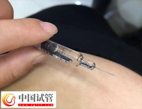 试管婴儿长方案和短方案哪个好(图1) 试管婴儿长方案和短方案哪个好(图1)