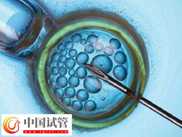 前往长沙做三代试管生孩子多少钱(图1) 前往长沙做三代试管生孩子多少钱(图1)