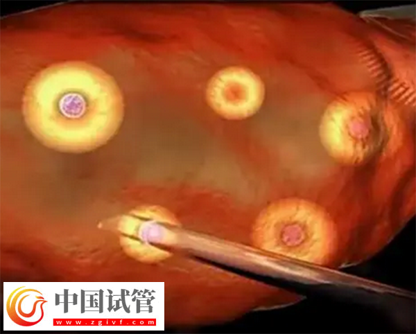 前往长沙做三代试管生孩子多少钱(图3) 前往长沙做三代试管生孩子多少钱(图3)