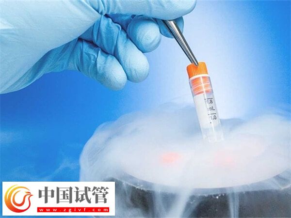 试管冻精费用是多少(图1) 试管冻精费用是多少(图1)