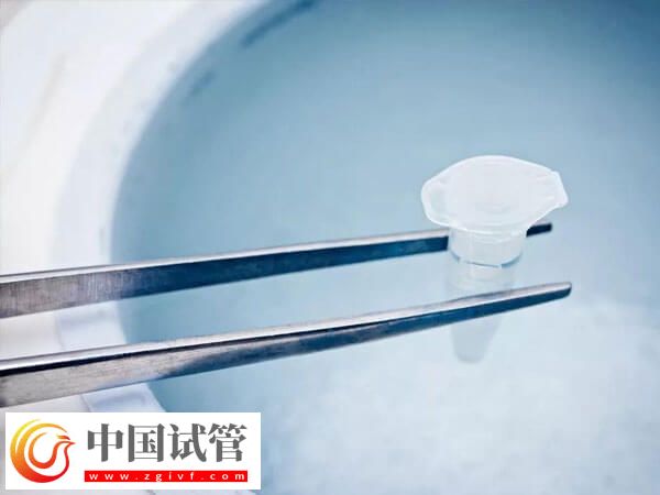 试管冻精费用是多少(图2) 试管冻精费用是多少(图2)