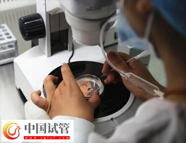 胚胎质量一般是移植还是促排好(图2) 胚胎质量一般是移植还是促排好(图2)