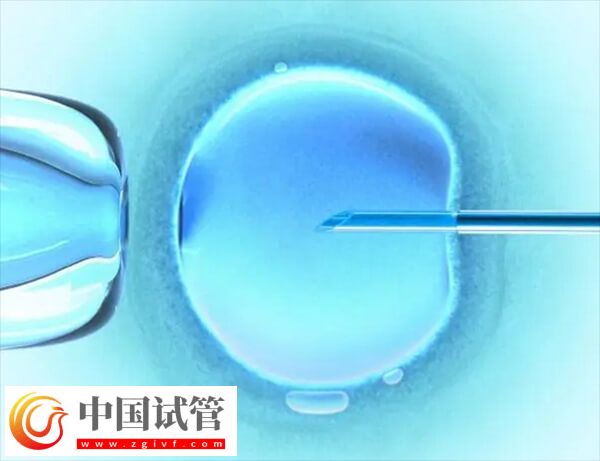三代试管可不可以单精子注射(图1) 三代试管可不可以单精子注射(图1)