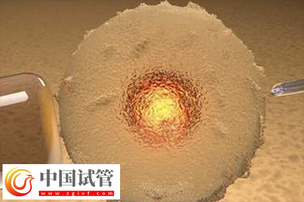 前往俄罗斯做试管合不合法(图1) 前往俄罗斯做试管合不合法(图1)