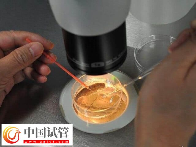 胚胎着床失败是什么情况(图1) 胚胎着床失败是什么情况(图1)