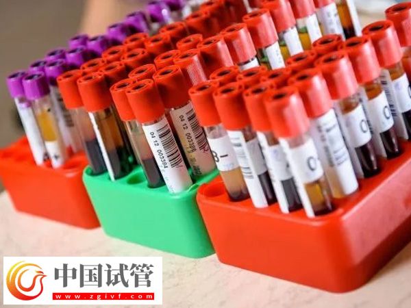 在东莞人民医院做试管成功率高不高(图2) 在东莞人民医院做试管成功率高不高(图2)