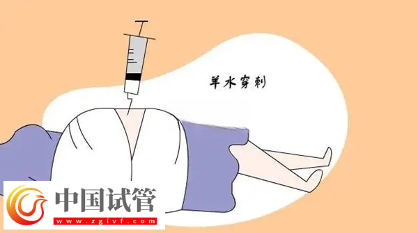 申请供精试管怀孕必须要查羊穿(图1) 申请供精试管怀孕必须要查羊穿(图1)