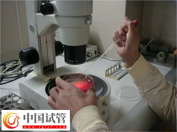 试管婴儿能否一次移植成功(图1) 试管婴儿能否一次移植成功(图1)