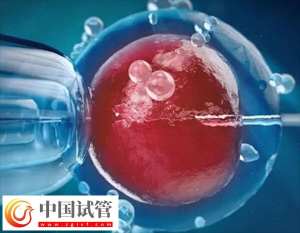 试管婴儿能否一次移植成功(图2) 试管婴儿能否一次移植成功(图2)
