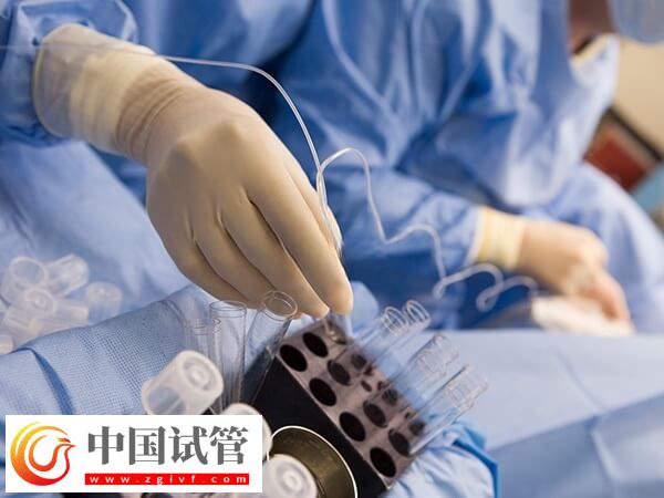 做试管婴儿的时间怎么安排(图1) 做试管婴儿的时间怎么安排(图1)