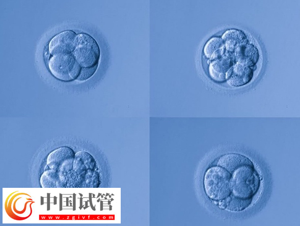 试管婴儿fet移植成功率是多少(图1) 试管婴儿fet移植成功率是多少(图1)