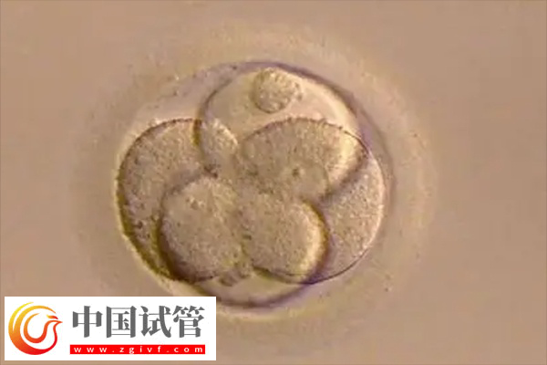 试管原肠胚能不能进行胚胎移植手术(图1) 试管原肠胚能不能进行胚胎移植手术(图1)